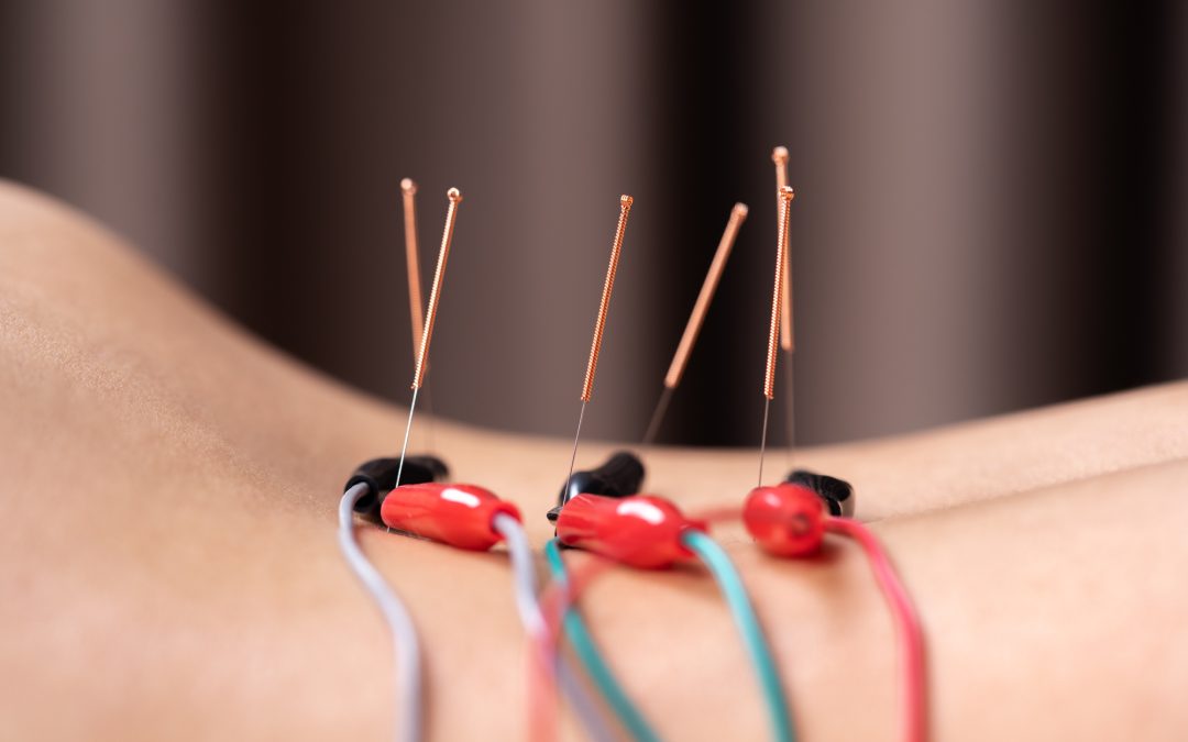 Electroacupuncture: Treatment with shockingly good results.